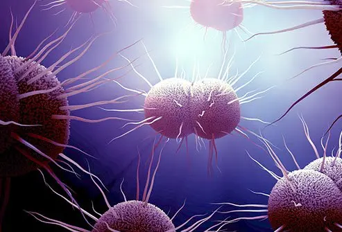 gonorrhea symptoms female — Gonorrhea Symptoms in Females: What They Feel Like and What to Do Next